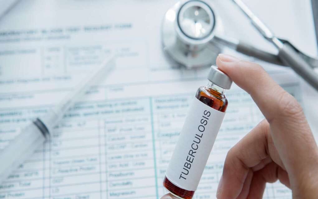 publican-nature-investigador-tec-tuberculosis