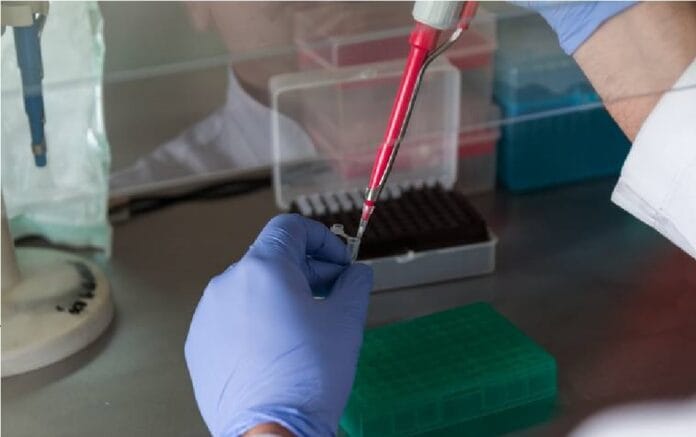 Caso positivo de viruela del mono en Tampico está bajo vigilancia epidemiológica extrema